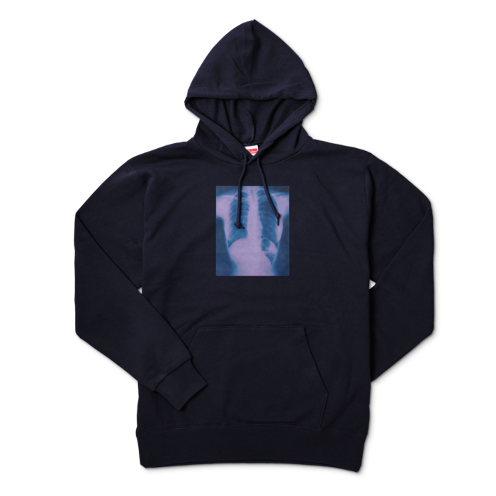XL