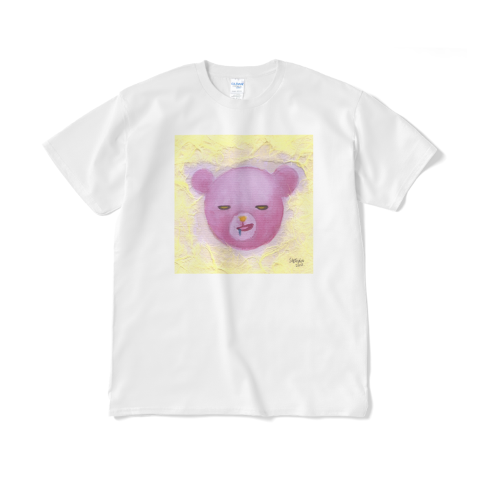 XL