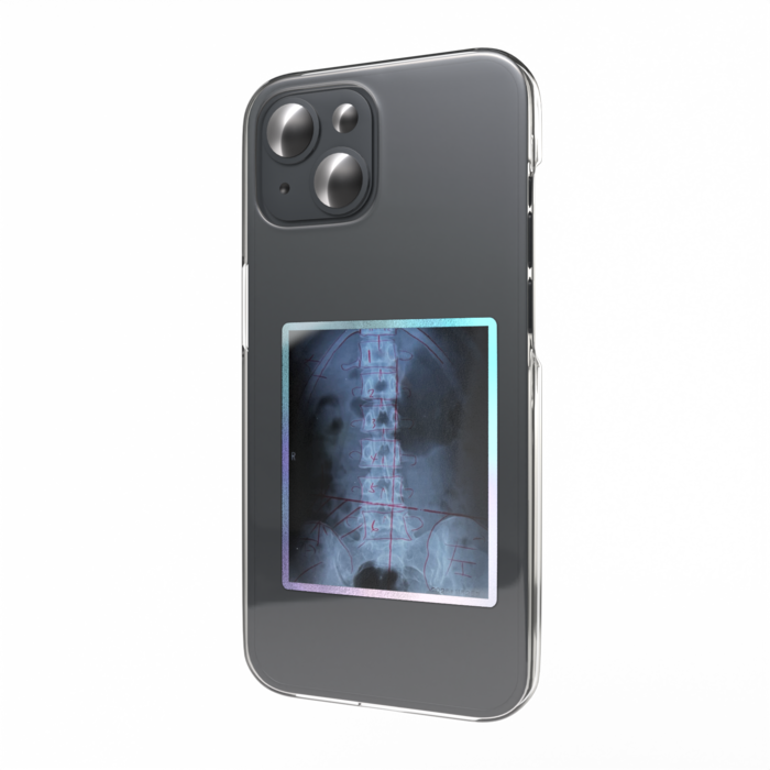 オーロラスマホステッカー - 縦